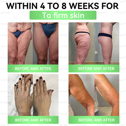 Iyocare® has a surprise upgrade just for you! You've already got an amazing offer but now you've unlocked an even better one: You'll get a massive 50% off your next purchase - for the next two minutes only!